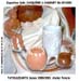 litvase1